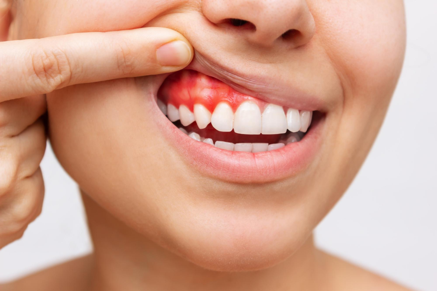 Gum Treatment